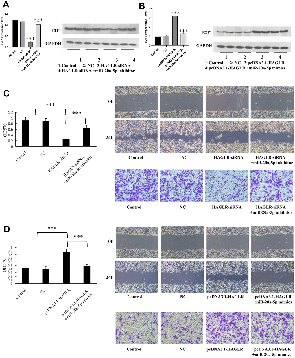 HAGLR/miR-20a-5p axis modulates the proliferation, migration, and invasion in GC. (A) HAGLR knockdown regulates E2F1 mRNA and protein. (B) HAGLR overexpression regulates E2F1 mRNA and protein. (C) HAGLR knockdown mediates the proliferation, migration, and invasion of GC cells. (D) HAGLR overexpression mediates the proliferation, migration, and invasion of GC cells. (*P 