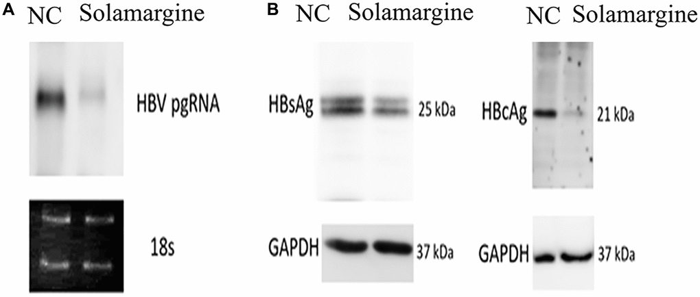 Effects of Solamargine on the relative expression levels of HBV pgRNA, HBsAg and HBcAg proteins. HBV plasmid was transfected into Huh7 cells; 2 d later, Solamargine (5 μM) was added into the cells, and the samples were collected after 1 d culture. (A) The relative expression of HBV pgRNA was detected by Northern blot. (B) The relative expression levels of HBsAg and HBcAg protein were detected by Western blot. The band strength was measured by Image-J software. Assays were performed in triplicate and results are presented as means ± SD.