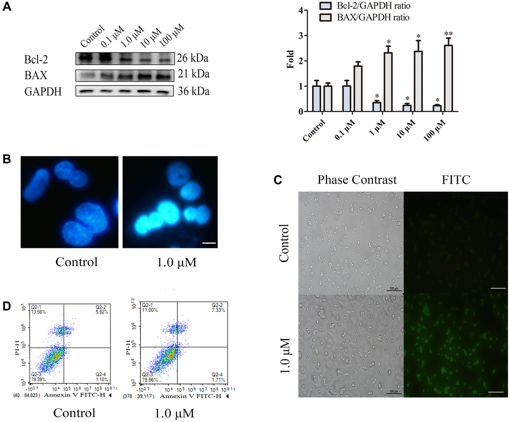 Nicotine induces apoptosis in THP-1 macrophages. (A) Dose-dependent expression of apoptosis-related proteins in THP-1 macrophages (24 h of exposure) analysed by WB. (B) Hoechst staining of THP-1 macrophages (bright blue represents the apoptotic cell nucleus) (scale bar: 50 μm). (C) TUNEL staining was used to evaluate the number of apoptotic THP-1 macrophages (green fluorescence indicates apoptotic cells) (scale bar: 50 μm). (D) Flow cytometry assay measuring apoptotic and necrotic cell levels. (n = 3. The data are presented as the mean ± SD. *P **P ***P 