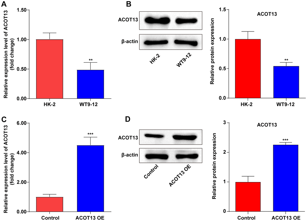 ACOT13 was downregulated in WT9-12 cells. (A) RT-qPCR was used to determine ACOT13 mRNA level in HK-2 and WT9-12 cells. **PB) Western blot assays were applied to assess ACOT13 protein level in HK-2 and WT9-12 cells. **PC) RT-qPCR was used to determine ACOT13 mRNA level in WT9-12 cells transfected with ACOT13 OE plasmids. ***PD) Western blot assays were applied to assess ACOT13 protein level in WT9-12 cells transfected with ACOT13 OE plasmids. ***P