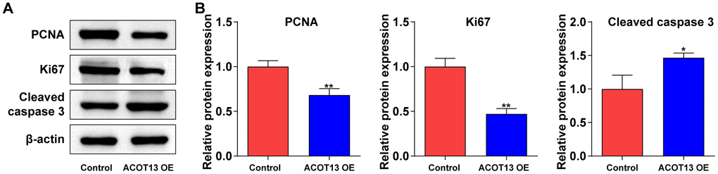 ACOT13 overexpression affected proliferation- and apoptosis-related proteins in WT9-12 cells. WT9-12 cells were transfected with ACOT13 OE plasmids. (A, B) Western blot assay was used to measure PCNA, Ki67 and cleaved caspase 3 expression levels in WT9-12 cells. *P