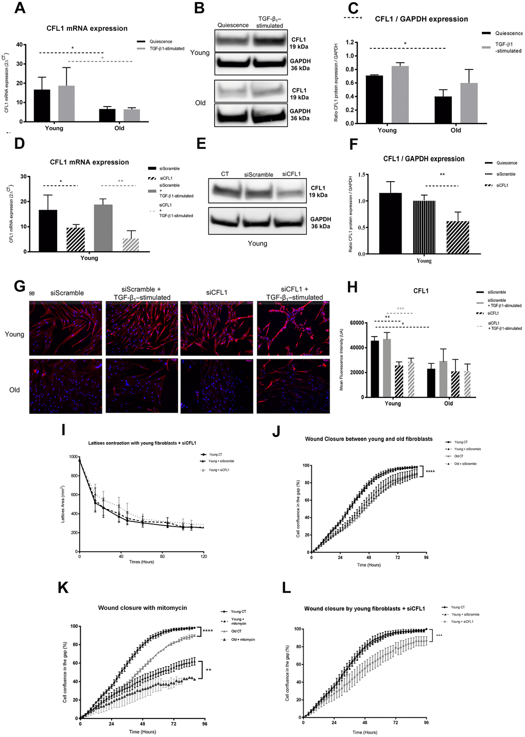 CFL1 analysis. (A) mRNA CFL1 expression (RT-qPCR) of fibroblasts in quiescence or after 24h of TGF-β-1 stimulation (Mean±SEM, n= 6 for young and old cells); (B) one representative western blot of CFL1 and GAPDH expression and (C) mean (±SD) quantification of CFL1/GAPDH ratio expression in quiescence or after a 24h-TGF-β-1 stimulation of young or old fibroblasts (n=3 per type); (D) mRNA expression quantified by RT-qPCR after transfection with specific siRNA for CFL1 (siCFL1) or with Scramble siRNA (siScramble), in quiescence or after a 24h-TGF-β-1 stimulation (Mean±SD, n=6 per type); (E) after transfection of young fibroblasts with specific siCFL1 or with siScramble, one representative western blot of CFL1 and GAPDH expression and (F) mean WB quantification of CFL1/GAPDH ratio expression (Mean±SD, n=3); (G) one representative immunofluorescence staining after transfection with specific siCFL1 or with siScramble of one representative young and one old fibroblast population, either in quiescence or after a 24h-TGF-β-1 stimulation and (H) in the same conditions, mean quantification of immunofluorescence staining from young or old fibroblasts (Mean±SD, n=6); (I) collagen gel contraction (lattice) of young fibroblasts either from control cultures or after transfection with specific siCFL1 or with siScramble during 120h (Mean±SD, n=6); (J) wound closure over 96h as measured by % of cell confluency for analysis of migration of young control fibroblasts (CT) or after transfection with siCFL1 or siScramble siRNA (Mean ±SD, n=6); (K) wound closure over 96h as measured by % of cell confluency for comparison of migration between young and old fibroblasts (Mean ±SD, n=6 per cell type); (L) wound closure over 96h as measured by % of cell confluency for analysis of migration with or without mitomycin-C inhibitor of young and old fibroblasts (Mean ±SD, n=6 per cell type). p-value *
