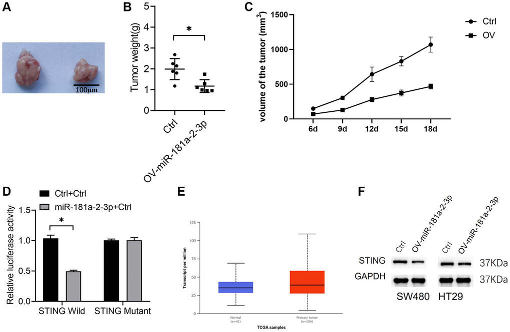 miR-181a-2-3p inhibits colon cancer in vivo and targets STING. (A) A nude mouse tumorigenic assay was used to assess the in vivo tumorigenic ability of colon cancer. (B) Weight of isolated tumors. (C) The volume change of the tumor. (D) A dual luciferase assay to measure miR-181a-2-3p and STING 3′-UTR regions. Note: The Y-axis is relative luciferase activity or expression, the ratio of Firefly Luciferase (luc2) and Renilla Luciferase (hRluc) to values in Wells of the same sample represents the relative luciferase expression. (E) STING expression was analyzed in colon cancer tissues based on the TCGA database. (F) Western blot analysis of STING expression in colon cancer cell lines overexpressing miR-181a-2-3p. Note: OV-miR-181a-2-3p is miR-181a-2-3p overexpression group. Ctrl is the control.