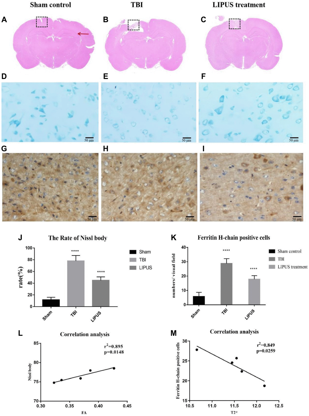 (A–C) Representative HE staining images of different groups are shown. The red arrows indicate the location of the hippocampus, and the dashed boxes represent the site of cortical injury on the right side. It can be observed that there was significant cavity formation in the TBI group, and the cavity area decreased after LIPUS treatment. (D–F) Histopathology of Nissl staining. Compared with the Sham control group, the neurons in the TBI group showed obvious edema, fewer cells, sparse arrangement, reduced Nissl bodies in the cytoplasm, and some cells were stained light blue. In the LIPUS treatment group, the nerve cells in the injured area were arranged densely and neatly, and the Nissl bodies were abundant in the cytoplasm. The Nissl corpuscles in the cerebral cortex were dark blue, the nucleus was light blue, and the background was light blue. Bar, 50 μm. (G–I) Immunohistochemical staining of Ferritin-H-chain in the ipsilateral cortex 7th day after TBI. Brown cells represented positive for ferritin-H-chain, which were mainly located in neuron-like cells and occasionally in glia-like cells. The number of positive cells in TBI group and LIPUS group was significantly higher than that in Sham group. Obvious brown staining was observed in the cytoplasm in TBI group, and the staining in LIPUS group was lighter than that in TBI group. (J) The rate of Nissl body in the LIPUS group was obviously lower than TBI group. (K) The number of positive cells in TBI group and LIPUS group was significantly higher than that in Sham group. (L, M) Correlation analysis. In the TBI group, FA values were positively correlated with neuronal damage and T2* values were negatively correlated with ferritin. Data are Mean ± SD. One way-ANOVA, ****P 