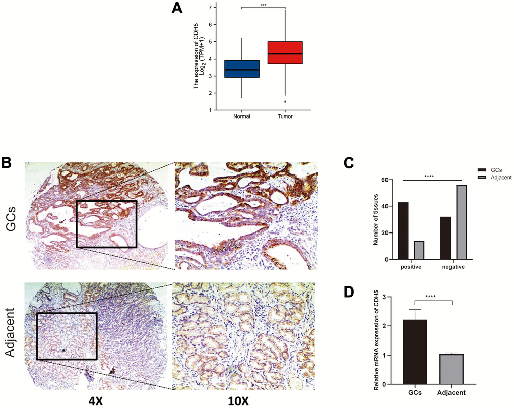 CDH5 expression was upregulated in gastric cancer tissues. (A) Expression level of the CDH5 gene in the GC samples compared to normal tissues through GEPIA. (B) Representative photomicrographs of IHC staining show CDH5 expression in gastric cancer tissues and adjacent normal breast tissues in tissue microarrays. Magnification×40 (left) and ×100 (right). (C) The difference in CDH5 expression levels between GC tissues and adjacent tissues in tissue microarrays. (D) The difference in mRNA expression levels of CDH5 between GC tissues and adjacent tissues form 32-pair clinical tissue samples. **** P