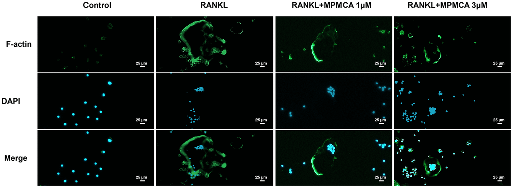 MPMCA inhibits RANKL-induced F-actin expression. The RAW 264.7 cells were exposed to RANKL and MPMCA at doses of 1 μM and 3 μM respectively, for a period of 7 days (n = 3). The F-actin is represented by green, whilst the nuclei are stained with DAPI and presented in blue.