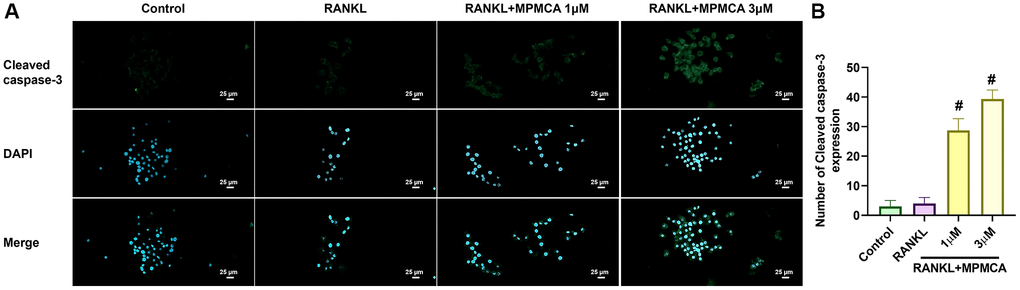 MPMCA enhances the level of cleaved caspase-3 in mature osteoclasts. (A) Immunofluorescence staining was performed on RAW 264.7 cells to detect cleaved caspase-3. The cells were initially stimulated with RANKL for 5 days, and then treated with RANKL and MPMCA for an additional 2 days. Cleaved caspase-3 is indicated by green, while the staining for nuclei using DAPI is shown in blue. (B) The enumeration of cells that had positive staining was conducted (n = 3). *p #p 