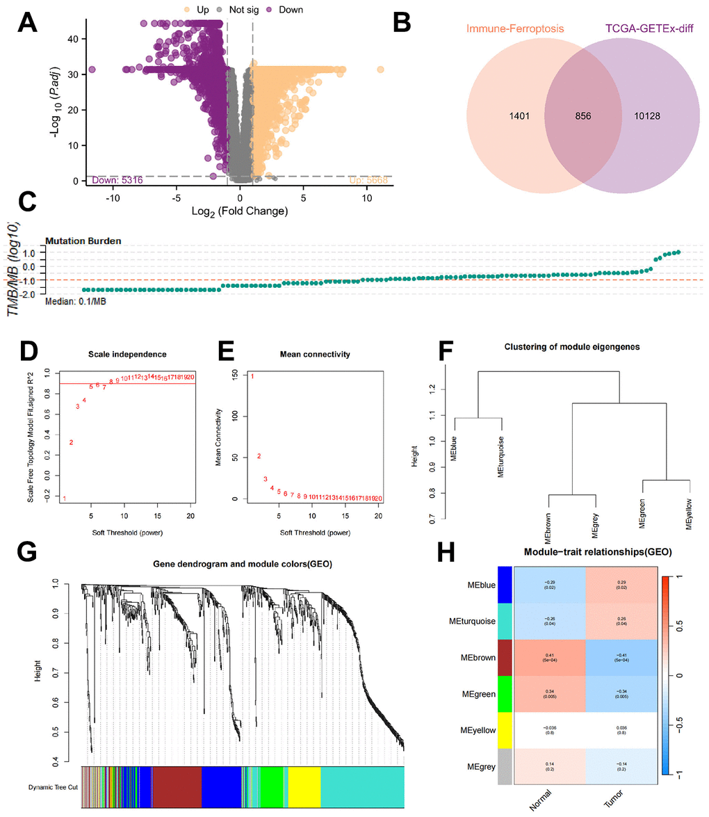 Identification of the ferroptosis-related genes. (A) Differential gene screening revealed a total of 5668 upregulated genes and 5316 downregulated genes based on the threshold. (B) By taking the intersection, 856 genes were identified as candidate genes for subsequent analysis. (C) Accumulation of TMB in each patient. (D, E) To establish scale-free networks, the soft thresholding power was set to β=6 based on scale independence and mean connectivity. (F, G) The dynamic tree cut package was used to generate a gene cluster dendrogram containing 6 coexpression models. (H) The coexpression models are shown in blue, turquoise, brown, green, yellow, and gray and contain 146, 218, 128, 70, 81, and 43 genes, respectively. p 
