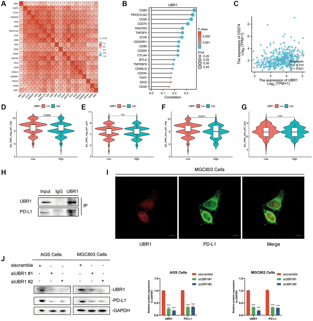 Interaction between UBR1 and PD-L1 in Gastric Cancer. (A) The results indicated a statistically significant correlation (p B) These genes were ranked by correlation size and presented in a lollipop plot, highlighting the top five genes: CD80, PDCD1LG2, CD28, PD-L1, and HAVCR2. (C) The correlation between UBR1 and PD-L1 in stomach adenocarcinoma (STAD) was further validated using the TCGA database, showing a significant positive correlation (R = 0.314, p D–G) Immune scores and responses to immunotherapy were analyzed in UBR1 low- and high-expression groups, revealing significant differences in response among different patient cohorts. (H) Immunoprecipitation assays in MGC803 cells confirmed the binding affinity between UBR1 and PD-L1 proteins. (I) Immunofluorescence assays in MGC803 cells verified the colocalization of UBR1 and PD-L1 proteins. (J) Analysis of PD-L1 protein expression in null and UBR1 knockdown cell lines (AGS and MGC803) showed decreased PD-L1 expression following UBR1 knockdown.
