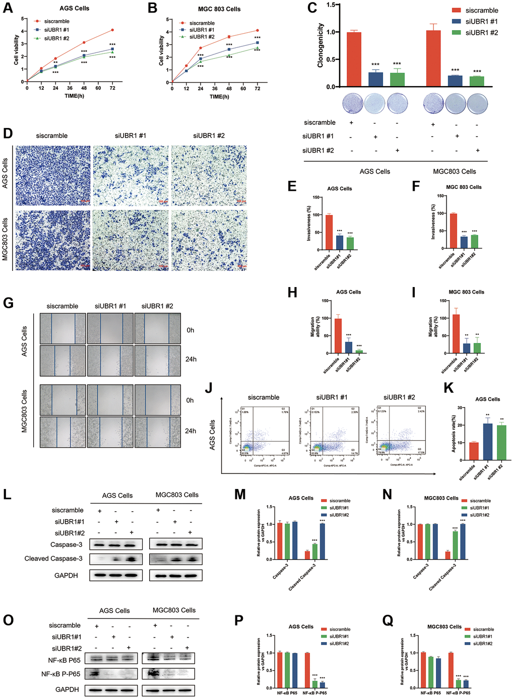Effects of UBR1 knockdown on proliferation, colony formation, invasion, migration, apoptosis, and NF-κB P65 pathway in AGS and MGC803 cells. (A, B) Cell Counting Kit-8 (CCK8) assay results show that cell proliferation is significantly inhibited in AGS and MGC803 cells at 24, 48, and 72 hours post-UBR1 knockdown (p C) Colony formation assay indicates a significant reduction in colony formation ability in both cell lines following UBR1 knockdown. (D–F) Transwell invasion assays demonstrate a significant decrease in the invasive capacity of AGS and MGC803 cells with UBR1 knockdown (p G–I) Wound healing assays reveal a significant reduction in the migratory ability of UBR1-knockdown cells (p J, K) Apoptosis analysis shows an increase in apoptosis in AGS cells post-UBR1 knockdown (p L–N) Western blot analysis of apoptosis-related proteins Caspase-3 and Cleaved Caspase-3 indicates an increase in Cleaved Caspase-3 expression in both cell lines after UBR1 knockdown. (O–Q) Western blot analysis of NF-κB pathway proteins shows a significant reduction in phosphorylated NF-κB P65 expression in UBR1-knockdown cells, suggesting involvement in the NF-κB pathway. In all panels, data are presented as mean ± standard deviation (SD), and statistical significance is indicated with asterisks (*p **p ***p 