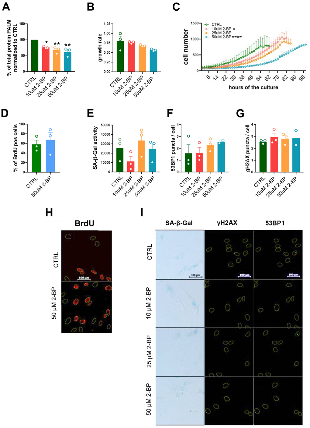 The influence of 2-BP treatment on cell proliferation and senescence. The graph shows the total protein palmitoylation normalized to the control after 24 h of 2-BP treatment (A). Analysis of the effects of different doses of 2-BP on the proliferation rate, as measured by growth rate calculations (B) and recording of cell numbers during a 4-day culture (C). Changes in the number of BrdU-positive cells (D), the level of SA-β-gal activity (E), and the number of DNA damage-associated 53BP1 foci (F) and γH2AX foci (G). Representative images of the measurements are shown in Panels (H) (BrdU incorporation) and (I) (SA-β-gal activity, 53BP1, γH2AX). The results are presented as the means ± SEMs from N=3 biological replicates. Statistical analysis was performed using one-way ANOVA or two-way ANOVA for (C), *p