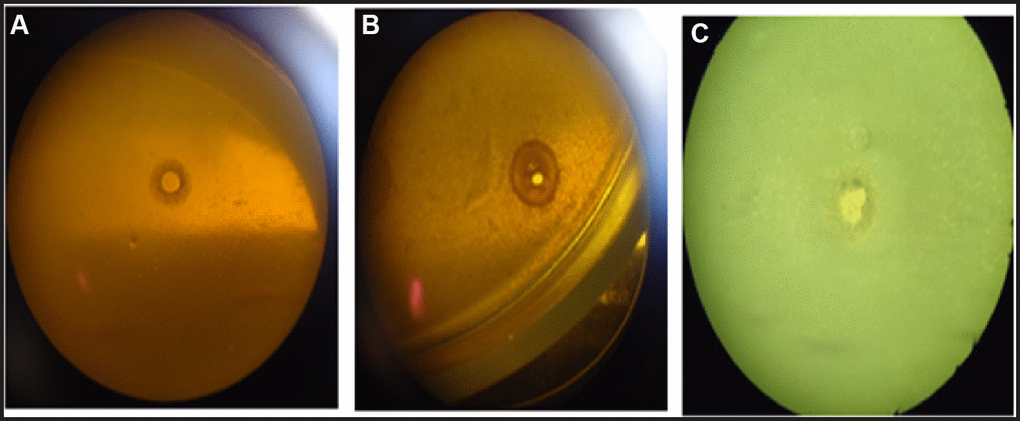 A lytic effect of vesicles: reference strains of S. aureus on B. subtilis (A); isolates of S. aureus on B. subtilis (B); reference strains of B. subtilis on reference strains of S. aureus (C).