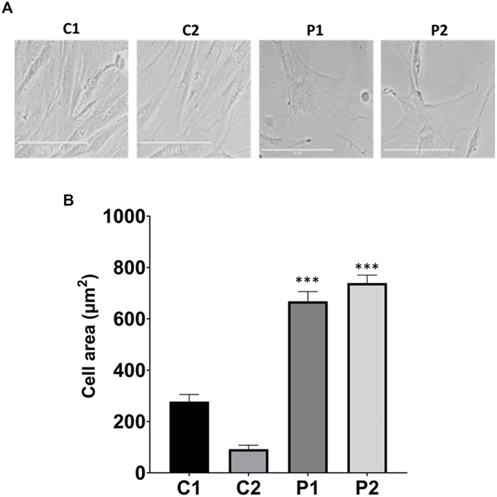Analysis of cell morphology in control (C1, C2) and patients (P1, P2) fibroblasts. (A) Representative images of morphological characterization. Scale bar = 20 μm. (B) Quantification of cell area. Data represent the mean ± SD of three independent experiments. ***p-value  between control and MS fibroblasts.