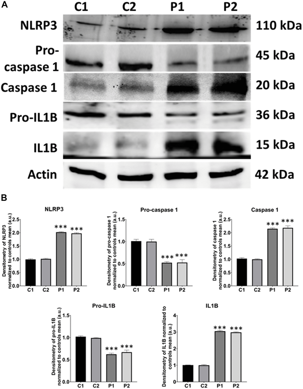 NLRP3 inflammasome analysis in control (C1, C2) and MS (P1, P2) fibroblasts. (A) Immunoblotting analysis of proteins related to NLRP3 inflammasome. Actin was used as the loading control. (B) Band densitometry of Western Blot data normalized to the mean of controls and referred to actin levels. Data represent the mean ± SD of three separate experiments. ***p-value  between control and MS cells.
