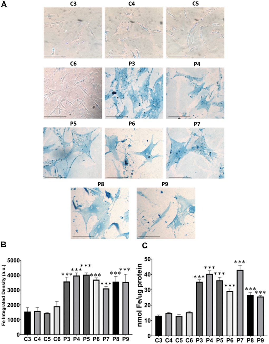 Iron accumulation in MS cells. (A) Representative images of Prussian Blue Staining in four control cell lines (C3, C4, C5, C6) and seven patient cell lines (P3, P4, P5, P6, P7, P8, P9). (B) Quantification of iron integrated density. (C) Iron levels determined by ICP-MS. Data represent the mean ± SD of three independent experiments. ***p-value  between control and patients’ cells. Scale bar = 20 μm. a.u.: arbitrary units.