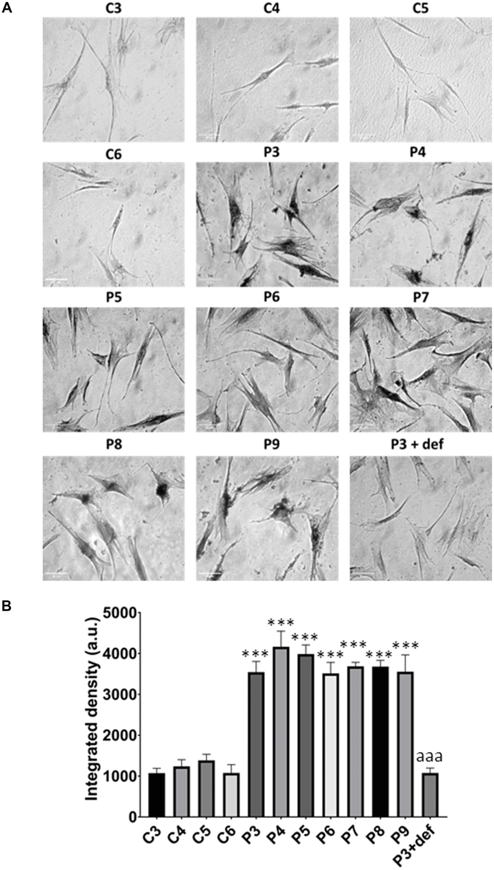 Lipofuscin accumulation. (A) Representative images of Sudan Black staining of control (C3,C4,C5,C6) and patients’ cells (P3, P4, P5, P6, P7, P8, P9). P3 treated with deferiprone at 100 μM (P3 + def) was used as a negative control. (B) Quantification of Sudan Black staining. Scale bar = 20 μm. Data represent the mean ± SD of three separate experiments. ***p-value  between control and MS fibroblasts. aaap-value  between untreated and deferiprone-treated P3 cells. a.u.: arbitrary units.