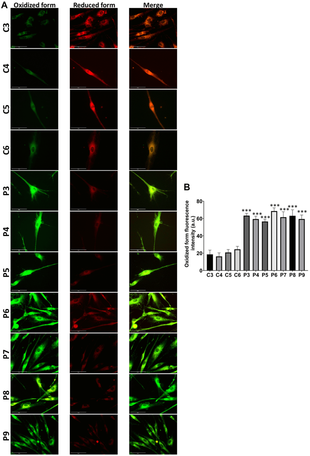 Lipid peroxidation in control (C3, C4, C5, C6) and MS (P3, P4, P5, P6, P7, P8, P9) cells. (A) Representative images of lipid peroxidation by BODIPY® 581/591 C11 staining. Scale bar = 20 μm. (B) Quantification of oxidized form fluorescence intensity. Data represent the mean ± SD of three independent experiments. ***p-value  between control and MS fibroblasts.