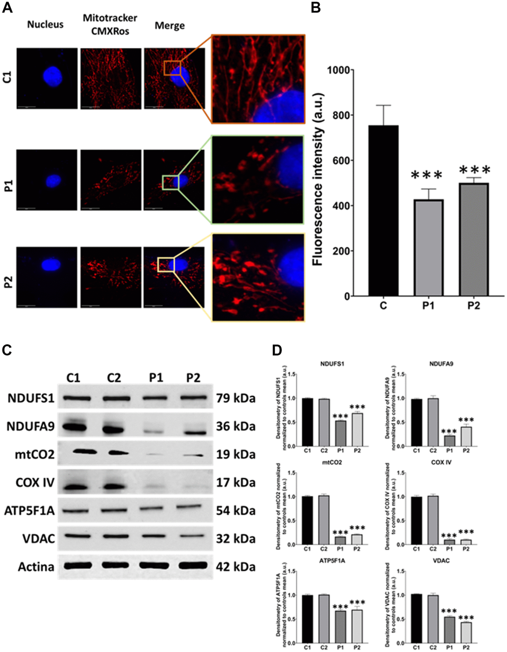 Mitochondrial network morphology and polarization, and protein expression levels in control (C1, C2) and MS (P1, P2) fibroblasts. (A) Representative images, acquired from a DeltaVision microscope. Scale bar = 20 μm. (B) Quantification of fluorescence intensity. C represents the mean of C1 and C2 data. (C) Immunoblotting analysis of mitochondrial proteins from complex I (NDUFS1, NDUFA9), complex IV (mtCO2, COX IV), and complex V (ATP5F1A). VDAC was used as a mitochondrial mass marker. Actin was used as the loading control. (D) Band densitometry of Western Blot data normalized to the mean of controls and referred to actin levels. Data represent the mean ± SD of three independent experiments. ***p-value  between control and MS cells. a.u.: arbitrary units.