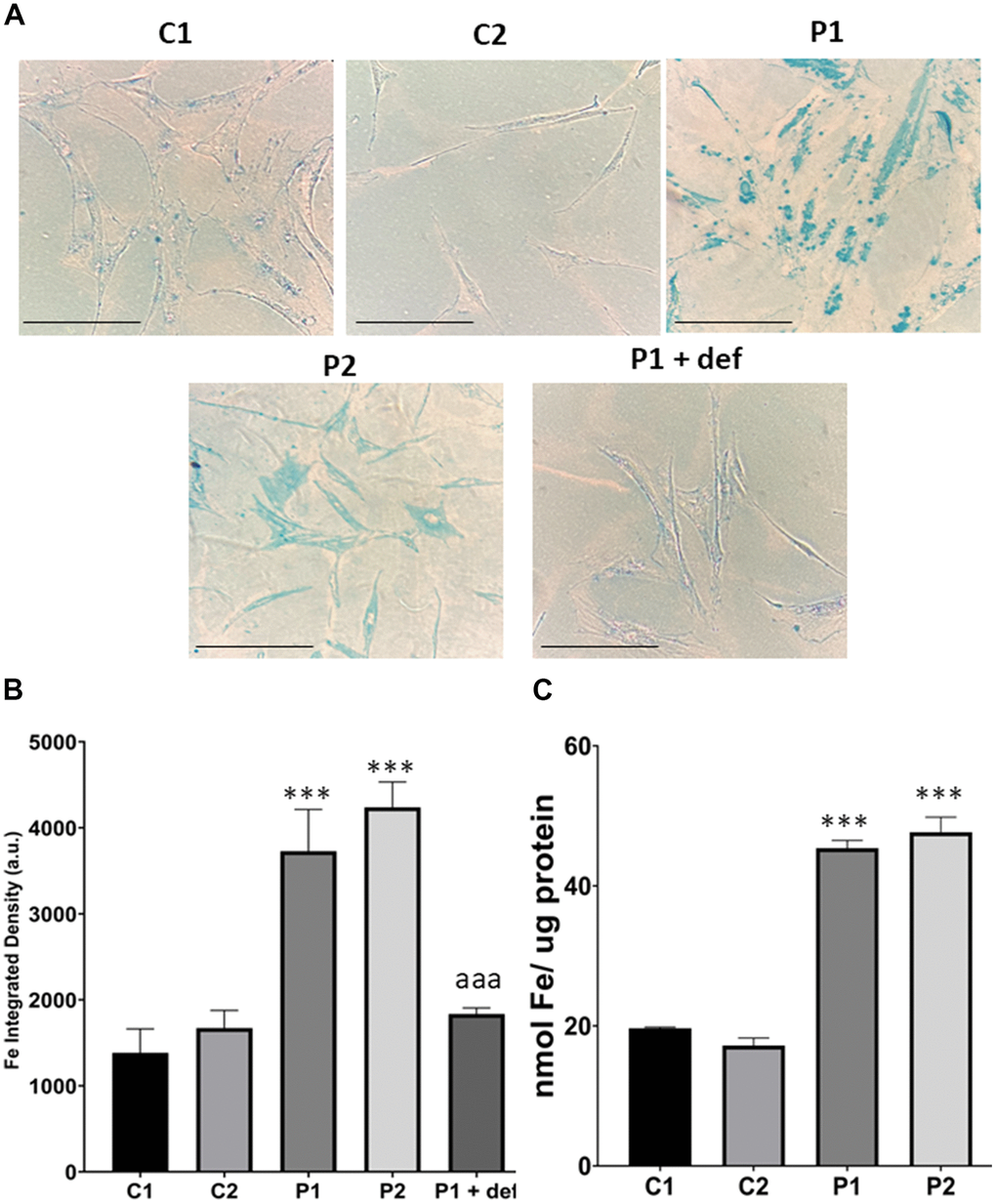 Iron accumulation in control (C1, C2) and MS (P1, P2) fibroblasts. (A) Representative images of Prussian Blue staining. Scale bar = 20 μm. (B) Quantification of iron integrated density. (C) Iron content measured by ICP-MS. Data represent the mean ± SD of three independent experiments. ***p-value  between control and MS cells. aaap-value  between untreated and deferiprone-treated P1 cells. a.u.: arbitrary units.