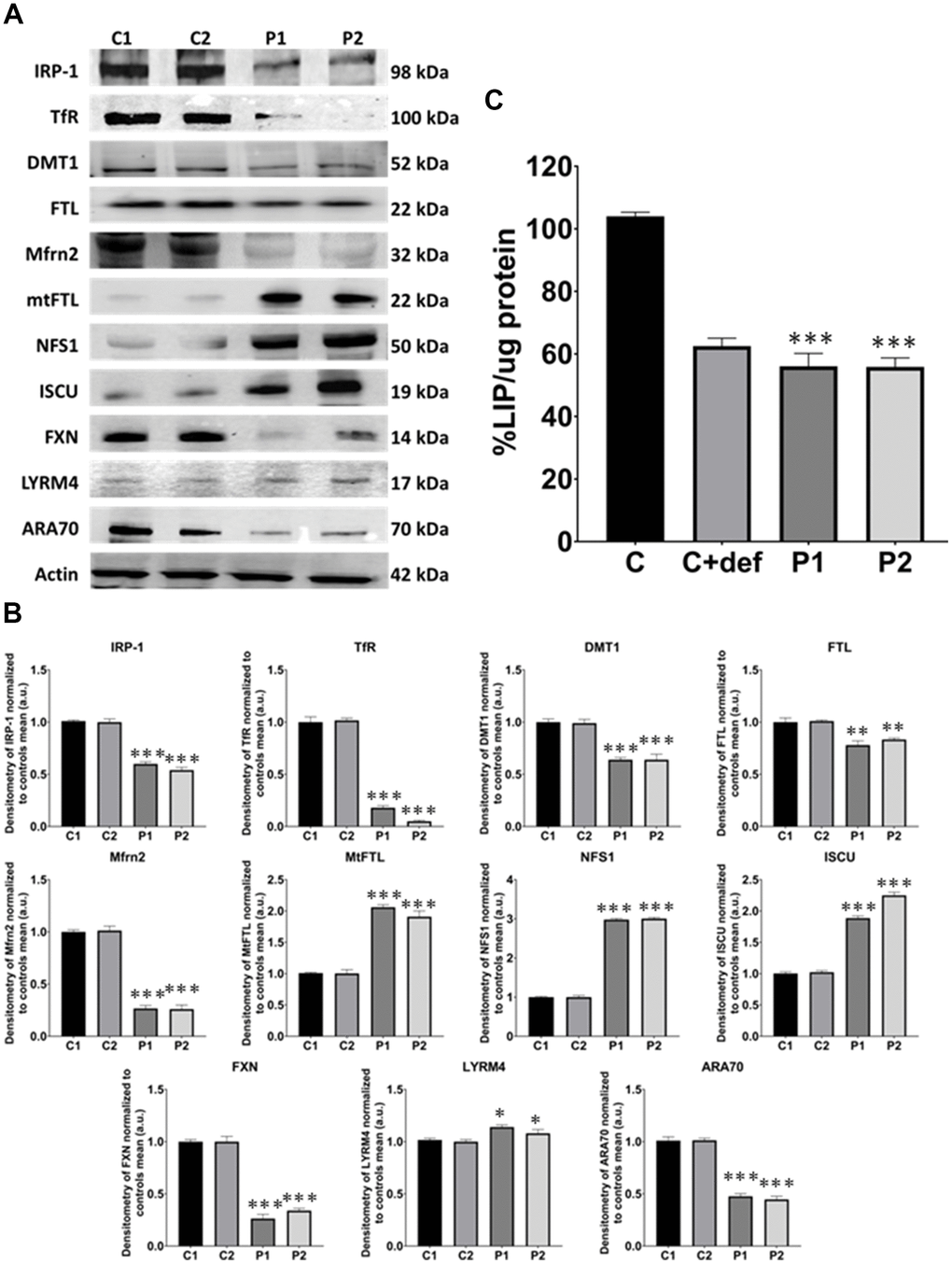 Iron metabolism analysis in control (C1, C2) and MS (P1, P2) fibroblasts. (A) Immunoblotting analysis of proteins implicated in iron metabolism. Actin was used as the loading control. (B) Band densitometry of Western Blot data normalized to the mean of controls and referred to actin levels. (C) LIP percentage. C represents the mean of C1 and C2 data. C1 and C2 cells treated with 100 μM deferiprone were used as a negative control. Data represent the mean ± SD of three separate experiments. *p-value , ***p-value  between control and MS fibroblasts.