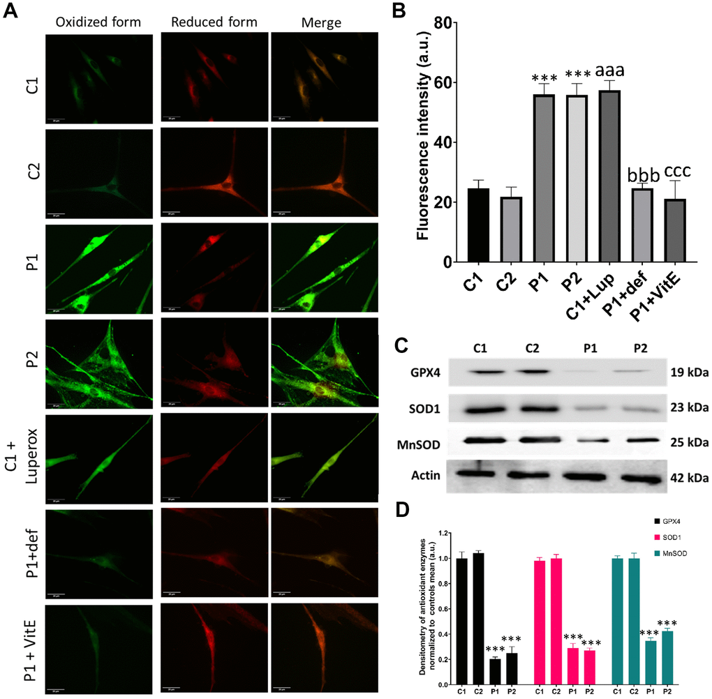 Lipid peroxidation and antioxidant response in control (C1, C2) and MS (P1, P2) fibroblasts. C1 cells treated with 500 μM Luperox® (C1 + Luperox) were used as a positive control. P1 cells treated with 100 μM deferiprone (P1 + def) or 50 μM vitamin E (P1 + VitE) were used as negative controls. (A) Representative images of lipid peroxidation assessed by Bodipy® 581/591 C11 staining. Scale bar = 20 μm. (B) Quantification of oxidized form fluorescence intensity. (C) Immunoblotting analysis of antioxidant enzymes. Actin was used as the loading control. (D) Band densitometry of Western Blot data normalized to the mean of controls and referred to actin levels. Data represent the mean ± SD of three separate experiments. ***p-value  between control and MS fibroblasts. aaap-value  between untreated and Luperox®-treated C1 cells. bbbp-value  between untreated and deferiprone-treated P1 cells. cccp-value  between untreated and vitamin E-treated P1 cells. a.u.: arbitrary units.