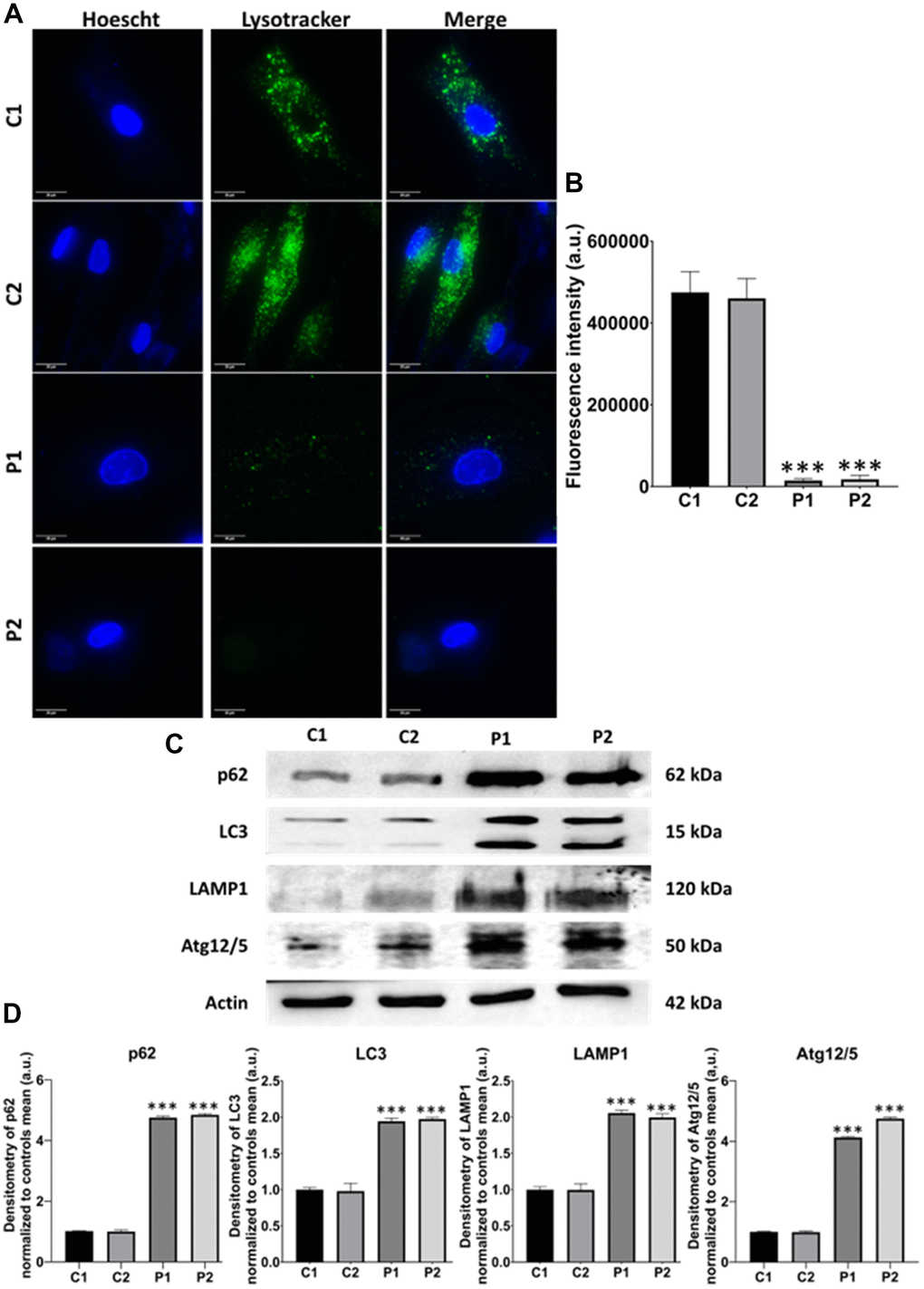Evaluation of autophagy in control (C1, C2) and MS (P1, P2) cells. (A) Representative images of Lysotracker™ Green staining. Cells were stained with 75 nM Lysotracker™ Green for 1 hour. Nuclei were visualized by DAPI staining. Scale bar = 20 μm. (B) Quantification of fluorescence intensity. (C) Immunoblotting analysis of proteins related to autophagy. Actin was used as the loading control. (D) Densitometry of Western Blot data normalized to the mean of controls and referred to actin levels. Data represent the mean ± SD of three independent experiments. ***p-value 