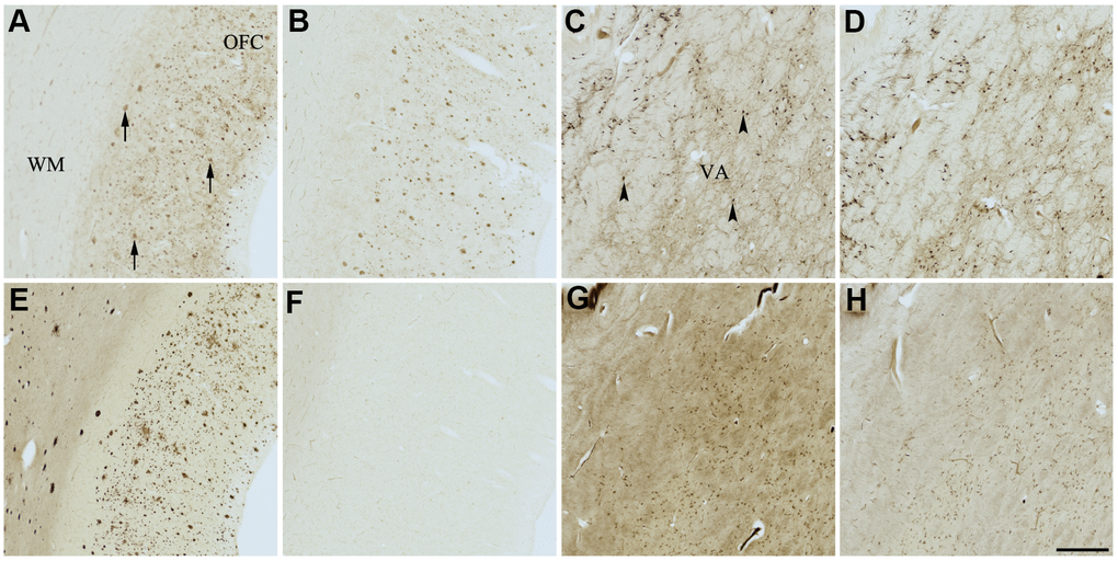 Effect of GW2580 (5) on histochemical staining of acetylcholinesterase (AChE) and butyrylcholinesterase (BChE). Representative photomicrographs of histochemical staining of AChE (A–D) and BChE (E–H). Staining at pH 6.8 demonstrates AChE- (A) and BChE (E)-associated plaques in the Alzheimer’s disease (AD) orbitofrontal cortex (arrows). Staining at pH 8.0 demonstrates AChE (C) and BChE (G) associated with normal neural structures in the AD thalamus (arrowheads showing neurons). GW2580 (5) inhibits BChE (F) but not AChE (B) associated with AD plaques but not AChE (D) and BChE (H) associated with normal neural elements. Note, for ease of reference, identical images of the positive control staining of AChE and BChE at pH 6.8 and 8.0 (A, C, E, G) were used herein and in Figures 4–7, 9 (A, C, E, G) to help compare directly the effects of each senolytic or nootropic agent on the standard Karnovsky-Roots (KR) histochemical staining method. Abbreviations: OFC, orbitofrontal cortex; VA, ventroanterior thalamic nucleus; WM, white matter. Scale bar = 500 μm.