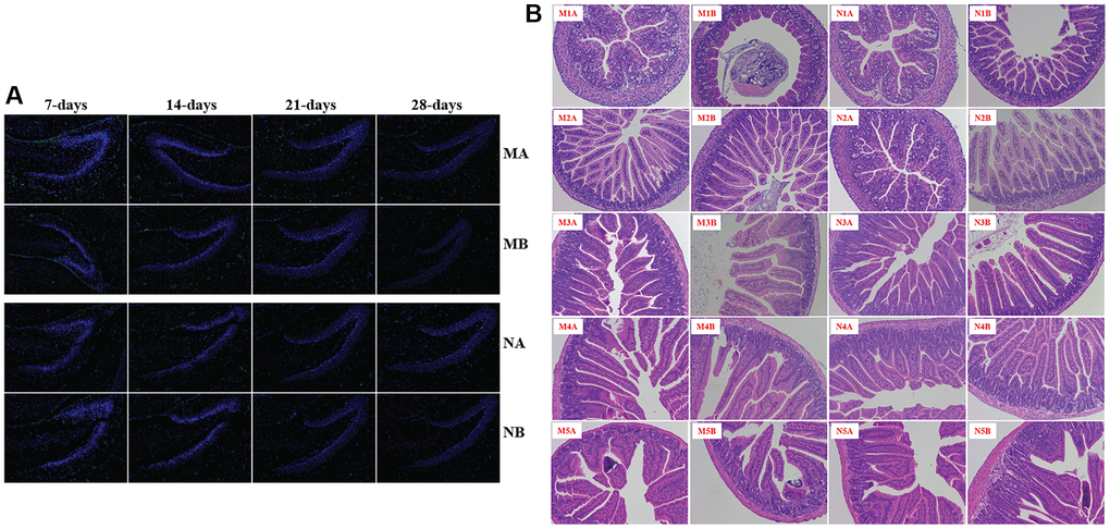 The pathological structure of brain and small intestine. IBA1 for microglia (A); H&E staining showed the pathological structure of the small intestine (B). The symbol of N1A is the 7-day control male samples, N1B is the 7-day control female samples, and N2A for 14-day, N3A for 21-day, N4A for 28-day, N5A for 56-day male samples, N2B for 14-day, N3B for 21-day, N4B for 28-day, N5B for 56-day female samples; M1A is the 7-day HSHF male samples, M1B is the 7-day HSHF female samples, and M2A for 14-day, M3A for 21-day, M4A for 28-day, M5A for 56-day male samples, M2B for 14-day, M3B for 21-day, M4B for 28-day, M5B for 56-day female samples.