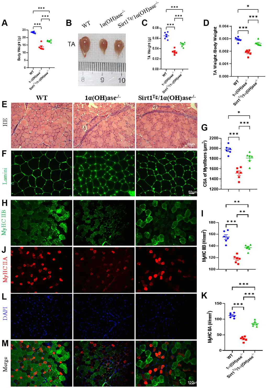 Sirt1 overexpression in MSCs corrects skeletal muscle mass reduction, muscle fiber atrophy and type II fiber loss caused by 1,25(OH)2D deficiency. (A) Body weight results, (B) gross images of tibialis anterior (TA) muscles and (C) muscle weight results. (D) Tibialis anterior muscle weight/body weight results from 2-month-old WT, 1α(OH)ase−/− and Sirt1Tg1α(OH)ase−/− male mice. (E) H&E staining micrographs. (F) Laminin immunofluorescence staining micrographs. (G) Tibialis anterior muscle cross-sectional area analysis results. (H) Tibialis anterior muscle MyHC II B immunofluorescence staining micrographs and (I) MyHC II B positive fiber number analysis. (J) Tibialis anterior muscle MyHC II A immunofluorescence staining micrographs and (K) MyHC II A positive fiber number analysis. (L) DAPI staining of tibialis anterior muscle sections. (M) Merged images of MyHC II B, MyHC II A and DAPI immunofluorescence staining in tibialis anterior muscle. 6 mice per group were used for experiments. *p **p ***p 