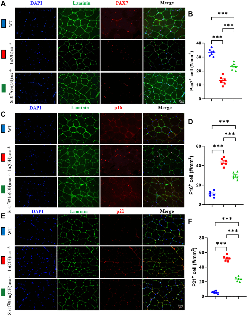 Sirt1 overexpression in MSCs corrects satellite cell reduction and skeletal muscle cell senescence caused by 1,25(OH)2D deficiency. (A) DAPI, Laminin and Pax7 immunofluorescence staining micrographs of tibialis anterior muscle from 2-month-old WT, 1α(OH)ase−/− and Sirt1Tg1α(OH)ase−/− male mice. (B) Statistical analysis of Pax7 positive cells in tibialis anterior muscle. (C) DAPI, Laminin and p16 immunofluorescence staining micrographs. (D) p16 positive cell analysis results. (E) DAPI, Laminin and p21 immunofluorescence staining micrographs from tibialis anterior muscle of 2-month-old mice of three genotypes. (F) p21 positive cell analysis results. 6 mice per group were used for experiments. *p **p ***p 