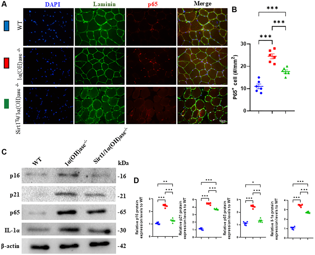 Sirt1 overexpression in MSCs corrects senescence-associated secretory phenotype (SASP) in skeletal muscle caused by 1,25(OH)2D deficiency. (A) DAPI, Laminin and p65 immunofluorescence staining micrographs of tibialis anterior muscle from 2-month-old male mice of three genotypes and (B) p65 positive cell analysis results. (C) Western blot showing changes in p16, p21, p65 and IL-1α protein levels in tibialis anterior muscle and (D) quantitative analysis of protein levels. 6 mice per group were used for experiments. *p **p ***p 