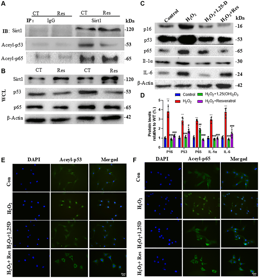 1,25(OH)2D3 or resveratrol inhibits C2C12 cell senescence and SASP by activating Sirt1 to decrease acetylated p53 and p65 levels and activities. (A) C2C12 cells were treated with 10 µM Resveratrol (Res) and Sirt1 protein immunoprecipitation followed by Western blot analysis of Sirt1, Acel-p53 and Aceyl-p65 expression. (B) Western blot analysis of Sirt1, p53 and p65 protein levels in whole cell lysates (WCL). (C) C2C12 cells were treated with 100 µM H2O2 alone or together with 10−8M 1,25(OH)2D3 or 10 µM Resveratrol for 24 hours, proteins were extracted and p16, p53, p65, IL-1α and IL-6 levels were determined by Western blot. (D) Quantitative analysis of protein levels. Experiments were performed in triplicate. *p ***p #p ##p ###p 2O2 alone. (E) Immunofluorescence staining showing subcellular localization of Acel-p53. (F) Immunofluorescence staining showing subcellular localization of Aceyl-p65.