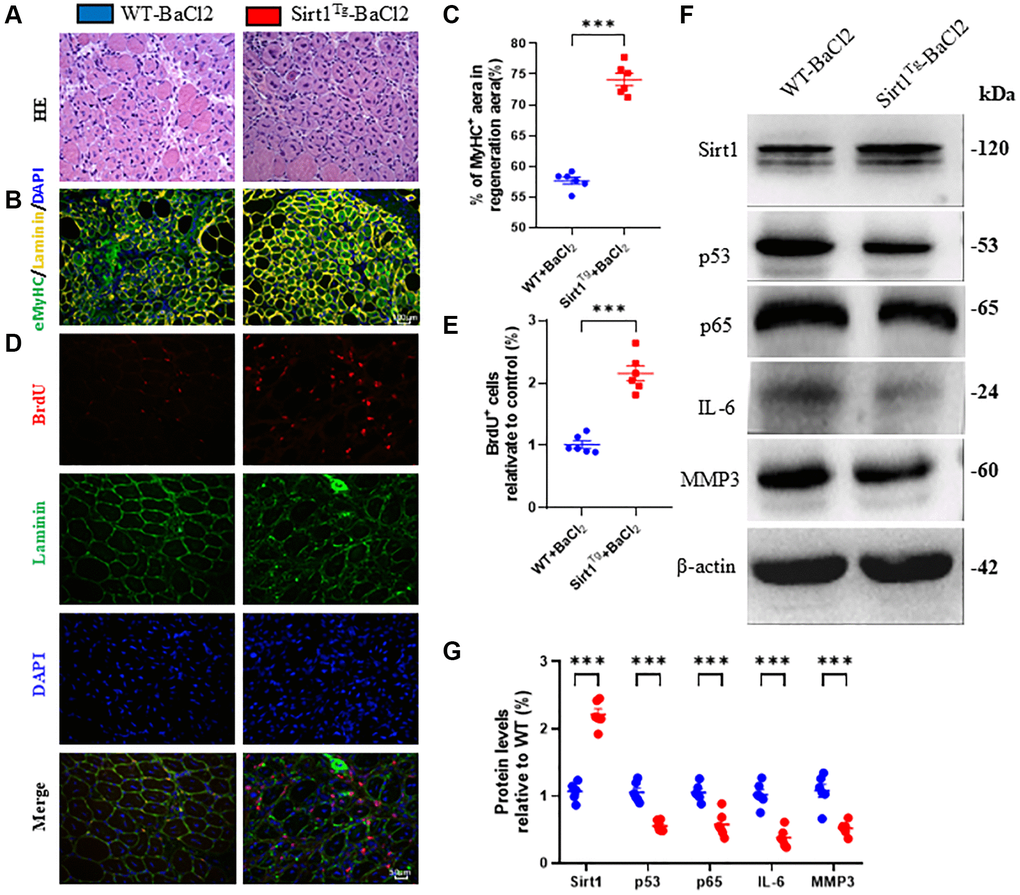 Sirt1 overexpression in MSCs accelerates skeletal muscle injury repair by promoting regeneration. (A) H&E staining micrographs of tibialis anterior muscle frozen sections from 2-month-old WT and Sirt1Tg mice after barium chloride (BaCl2) injury. (B) eMyHC/Laminin/DAPI immunofluorescence staining micrographs and (C) relative eMyHC+ newborn fiber area analysis. (D) BrdU/Laminin/DAPI immunofluorescence staining micrographs and (E) BrdU positive fiber number analysis. (F) Western blot analysis of Sirt1, p53, p65, IL-6 and Mmp3 protein levels in muscle tissues after BaCl2 injury and (G) quantitative protein analysis. 6 mice per group were used for experiments. *p **p ***p 