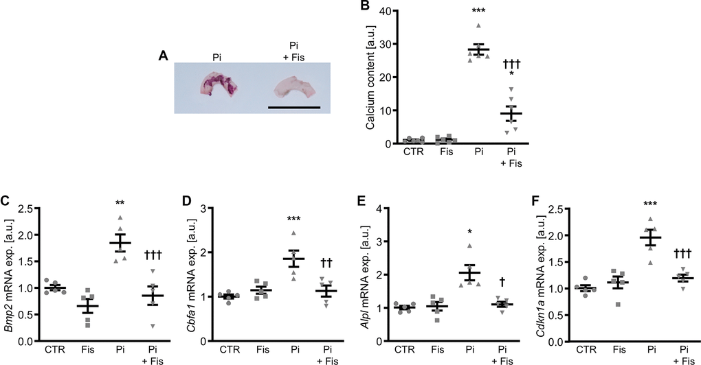 Effects of fisetin ex vivo in calcifying mouse aortic explants. Alizarin Red staining (A) of mouse aortic arches cultured for 7d in medium supplemented with 1.6 mM phosphate (Pi) without and with 1 μM fisetin (Fis). Calcification: red staining; scale bar: 5 mm. Normalized calcium content (n=6, B) in mouse aortic explants cultured for 7d in medium supplemented with control (CTR) or 1.6 mM phosphate (Pi) without and with 1 μM fisetin (Fis). Relative mRNA expression (n=5) of Bmp2 (C), Cbfa1 (D), Alpl (E) and Cdkn1a (F) in mouse aortic explants cultured for 7d in medium supplemented with control (CTR) or 1.6 mM phosphate (Pi) without and with 1 μM fisetin (Fis). *(p