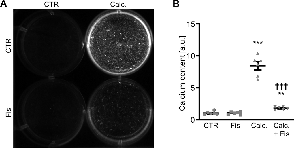 Effects of fisetin on calcification of VSMCs during pro-calcific conditions. Calcification detected by Osteosense fluorescence imaging (A) and normalized calcium content (n=6, B) in HAoSMCs treated for 11d with control (CTR) or calcification medium (Calc.) without and with 1 μM fisetin (Fis). Calcified areas: white pseudocolor. **(p