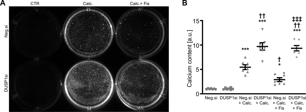 Effects of dual-specificity phosphatase 1 knockdown on the protective role of fisetin during VSMC calcification. Calcification detected by Osteosense fluorescence imaging (A) and normalized calcium content (n=7, B) in HAoSMCs transfected with negative control (Neg.si) or DUSP1 (DUSP1si) siRNA and treated for 11d with control (CTR) or calcification medium (Calc.) without and with 1 μM fisetin (Fis). Calcified areas: white pseudocolor. *(p