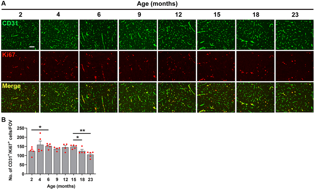 Characterization of hypoxia-induced brain endothelial proliferation at different ages. (A) Frozen brain sections taken from mice of different ages (2–23 months) exposed to hypoxia (8% O2) for 4 days were dual-stained for CD31 (AlexaFluor-488) and Ki67 (Cy-3). Images were captured in the midbrain. Scale bars = 100 μm. (B) Quantification of the density of CD31+/Ki67+ cells in the midbrain in different age mice following 4 days hypoxia. Results are expressed as the mean ± standard error of the mean (SEM) (n = 5 mice/group). *p **p 