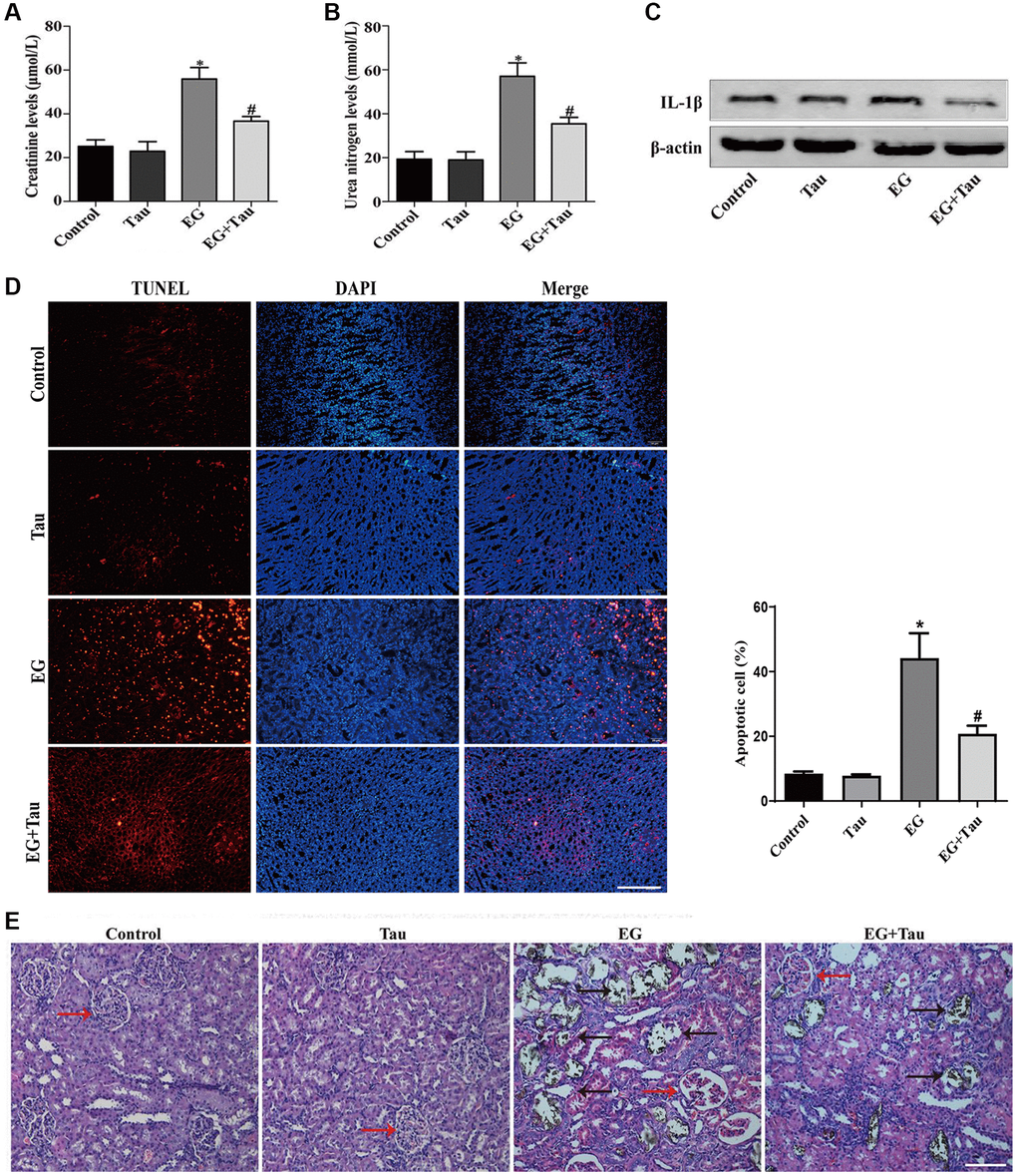 Tau attenuates EG-induced renal damage and crystal deposition in rat kidneys. (A) Effect of Tau on the serum expression of creatinine after EG-induced renal injury. (B) Effect of Tau on urea nitrogen following EG-induced renal injury. (C) Representative immunoblot and quantification analysis of IL-1β expression. (D) Renal tissue apoptosis was assessed by TUNEL staining; scale bar: 200 µm. (E) Kidney injury and crystal deposition were determined using Von Kossa-staining. Red and black arrows indicate glomerulus and crystal deposition, respectively; scale bar: 200 µm. Data are presented as the mean ± SD (n = 3). *P #P 