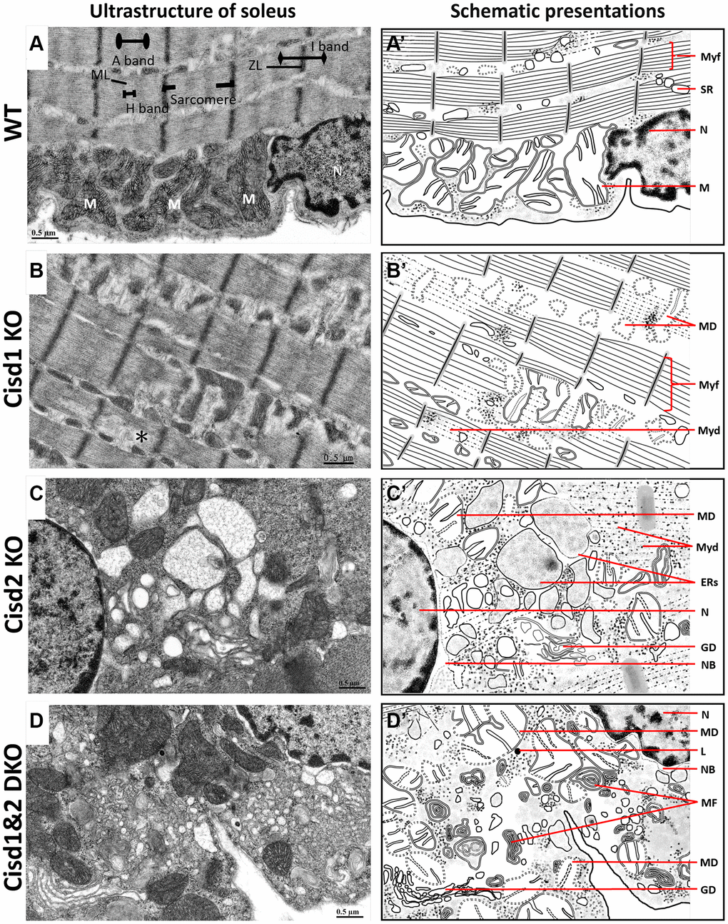 Ultrastructure of skeletal muscle (soleus) from Cisd1&2 DKO mice. (A) Architecture of the soleus in WT mice. ZL, Z line; ML, M line; M, mitochondria; N, nucleus. (B) Mitochondrial defects, myofibril degeneration (*) and ER stress in Cisd1 KO soleus. (C) Mitochondrial defect, myofibril degeneration, necrosis and ER stress in Cisd2 KO soleus. (D) Mitochondrial defect, myofibril degeneration, necrosis and ER stress in Cisd1&2 DKO soleus. (A–D) were shown at higher magnification (yellow squares) in Supplementary Figure 3. (A’–D’) are schematic presentations of the ultrastructure of the soleus shown in (A–D). Abbreviations: Ne: Nucleolus; NB: Nuclear envelope breakdown; MD: Mitochondrial defect; Myf: Myofibril; Myd: Myofibril degeneration; Ers: ER stress; ER: Endoplasmic Reticulum; SR: Sarcoplasmic Reticulum; Avi: Autophagosome; Avd: Autolysosome; L: Lysosome; MF: Myelin Figure; GD: Golgi degeneration. Mouse age, 5 weeks old.