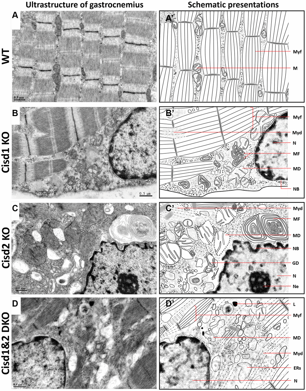 Ultrastructure of skeletal muscle (Gastrocnemius, Gas.) in Cisd1&2 DKO mice. (A) Architecture of soleus in WT mice. (B) Mitochondrial defects, necrosis and ER stress in Cisd1 KO soleus. (C) Mitochondrial defects, necrosis and ER stress in Cisd2 KO soleus. (D) Mitochondrial defects, myofibril degeneration, necrosis and ER stress in Cisd1&2 DKO soleus. (A–D) were shown at higher magnification (yellow squares) in Supplementary Figure 4. (A’–D’) are schematic presentations of the ultrastructure of the gastrocnemius shown in (A–D). Abbreviations: Ne: Nucleolus; NB: Nuclear envelope breakdown; MD: Mitochondrial defect; Myf: Myofibril; Myd: Myofibril degeneration; ERs: ER stress; ER: Endoplasmic Reticulum; L: Lysosome; MF: Myelin Figure; GD: Golgi degeneration. Mouse age, 5 weeks old.