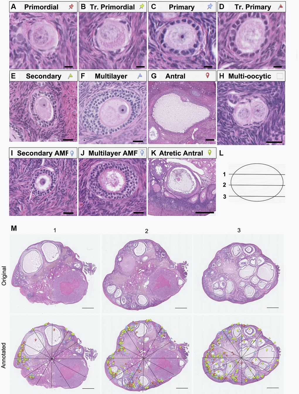 Representative images of follicle classes and follicle counting method schematic. Representative hematoxylin-and-eosin-stained images illustrating the following follicle classes are shown: (A) primordial, (B) transitional primordial), (C) primary, (D) transitional primary, (E) secondary, (F) multilayer, (G) antral, (H) multi-oocytic, (I) secondary with abnormal follicle morphology (AMF), (J) multilayer with AMF, (K) and atretic antral follicles. The follicle counting workflow depicting (L) the selection of representative ovarian sections from the top (1), middle (2), and bottom (3) quartiles of the ovary, and (M) schematic of follicle counting workflow, including dividing each section into twelve radial segments and annotation with colored markers as defined in A-K to mark and classify each follicle class. The scale bars are 10 μm (A–D), 25 μm (E, F, H, I and J), 250 μm (G), 500 μm (K), and 1 mm (N).