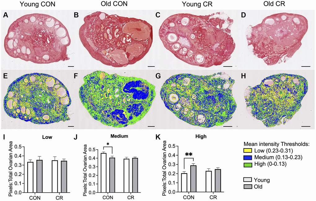 Assessment of collagen I and III in histologic ovarian sections using Picrosirius red (PSR). Representative images of PSR stained ovarian tissue sections for (A) young control, (B) old control, (C) young calorie-restricted (CR), and (D) old calorie-restricted (CR). Corresponding representative images of the quantitative histology algorithm showing intensity of PSR staining, where low intensity pixels are shown in yellow, medium intensity pixels are shown in blue, and high intensity are shown in green for (E) young control, (F) old control, (G) young calorie-restricted (CR), and (H) old calorie-restricted (CR). Bar graphs showing quantification of (I) low intensity, (J) medium intensity, and (K) high intensity pixels. An N = 3 images per animal and N = 4–8 animals per experimental group were analyzed. Data are presented as mean ± SEM. Statistics were calculated using a two-way ANOVA with Sidak’s multiple comparison test. *p ≤ 0.05. **p 0.01. The scale bar is 1 mm.