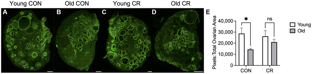 Hyaluronic acid binding protein localization in ovarian tissue sections. Representative fluorescent microscopy images of hyaluronic acid binding protein (HABP) showing localization of hyaluronic acid in ovarian tissue sections in (A) young control, (B) old control, (C) young calorie-restricted (CR), and (D) old calorie-restricted (CR) animals. Quantification of the positive pixels per area is shown in (E) with N = 3 images per animal and N = 4–8 animals per experimental group. Data are presented as mean ± SEM. Statistics were calculated using a two-way ANOVA with Sidak’s multiple comparison test. *p ≤ 0.05. The scale bar is 1 mm.
