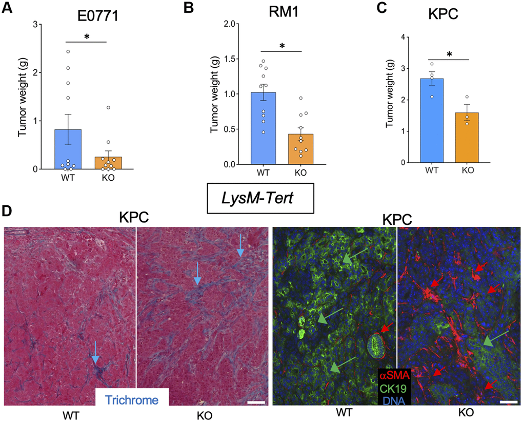 Tert KO in myeloid cells suppresses the growth of breast, prostate, and pancreatic tumors. Tissues resected from LysM-Cre; Tertfl/fl (KO) and LysM-Cre; Tert+/+ (WT) littermates were analyzed once one of the groups developed a critical tumor burden. (A) E0771 tumor weight upon resection. (B) RM1 tumor weight upon resection. (C) KPC tumor weight upon resection. (D) Representative paraffin sections of KPC tumors stained with Trichrome (left) or subjected to CK19 and α-SMA IF (right) revealing epithelial cells (green arrows) and myofibroblasts (red arrows). Scale bar: 100 μm. Shown are mean +/- SEM, *P
