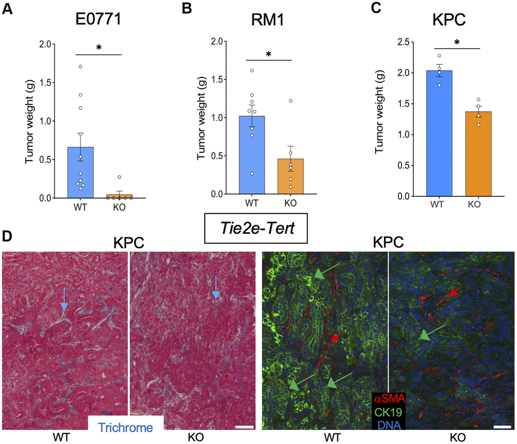 Tert KO in endothelial cells suppresses the growth of pancreatic tumors. Tissues resected from Tie2e-Cre; Tertfl/fl (KO) and Tie2e-Cre; Tert+/+ (WT) littermates were analyzed once one of the groups developed a critical tumor burden. (A) E0771 tumor weight upon resection. (B) RM1 tumor weight upon resection. (C) KPC tumor size weight upon resection. (D) Representative paraffin sections of KPC tumors stained with Trichrome (left) or subjected to CK19 and α-SMA IF (right) revealing epithelial cells (green arrows) and myofibroblasts (red arrows). Scale bar: 100 μm. Shown are mean +/- SEM, *P