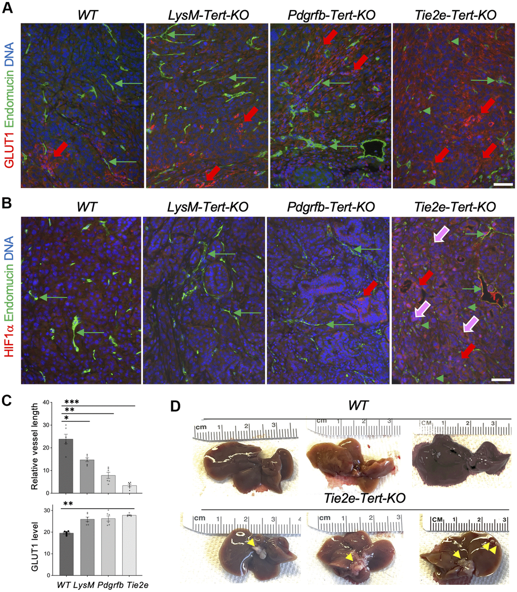 Tert KO in EC promotes pancreatic cancer metastasis linked with vasculature dysfunction and hypoxia. (A) Paraffin sections of representative KPC tumors from EC-Tert-KO and WT littermates subjected to IF showing GLUT1 expression in cancer cells (red arrows) and endomucin+ endothelium (GFP). (B) Paraffin sections of representative KPC tumors from indicated Tert-KO and WT littermates subjected to IF showing HIF1α expression in cancer cells (red arrows) and nuclear localization (purple arrows). Endomucin+ IF reveals blood vessels (green arrows) and isolated EC (green arrowheads). (C) Quantification of mean blood vessel length (A, B) and GLUT1 IF (A). Shown are mean +/- SEM, *PD) Representative livers from EC-Tert-KO and WT littermates with pancreatic KPC tumors with liver metastases indicated (arrows). DNA is blue. Scale bar: 100 μm.