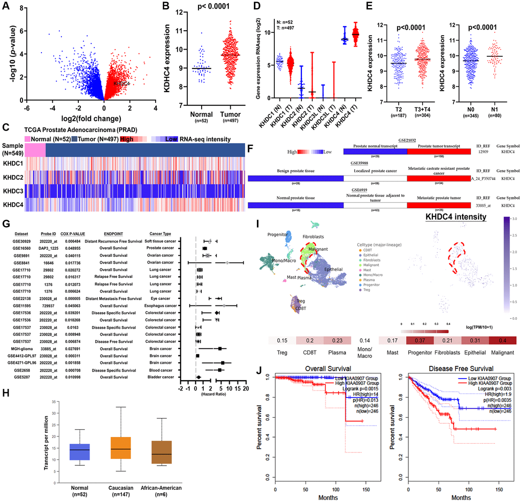 Increased KHDC4 levels are associated with the development of advanced prostate cancer. (A) The volcano plot illustrates an elevation in KHDC4 levels among patients in the late stage of TCGA-PRAD. (B) The associated expression intensity of KHDC4 in patients from TCGA-PRAD. (C) The correlated expression levels of KHDC members in patients from TCGA-PRAD. (D) The correlated expression intensity of KHDC4 in normal solid tissue and primary prostate tumor. (E) The difference in the level of KHDC4 between late-stage or lymph node metastasis in TCGA-PRAD patients. (F) The correlation of KHDC4 levels with advanced prostate cancer across different sources of prostate cohorts (GSE21032, GSE35988, GSE6919). (G) The correlation of KHDC4 levels with prognosis values in cancer across different cohort sources. (H) KHDC 4 expression levels across diverse racial backgrounds. (I) Analysis of single-cell sequencing profiles (GSE176031) reveals the relative expression intensity of KHDC4 across different cell types. (J) The prognostic impact of KHDC4 on overall survival and disease-free survival rates in prostate cancer.