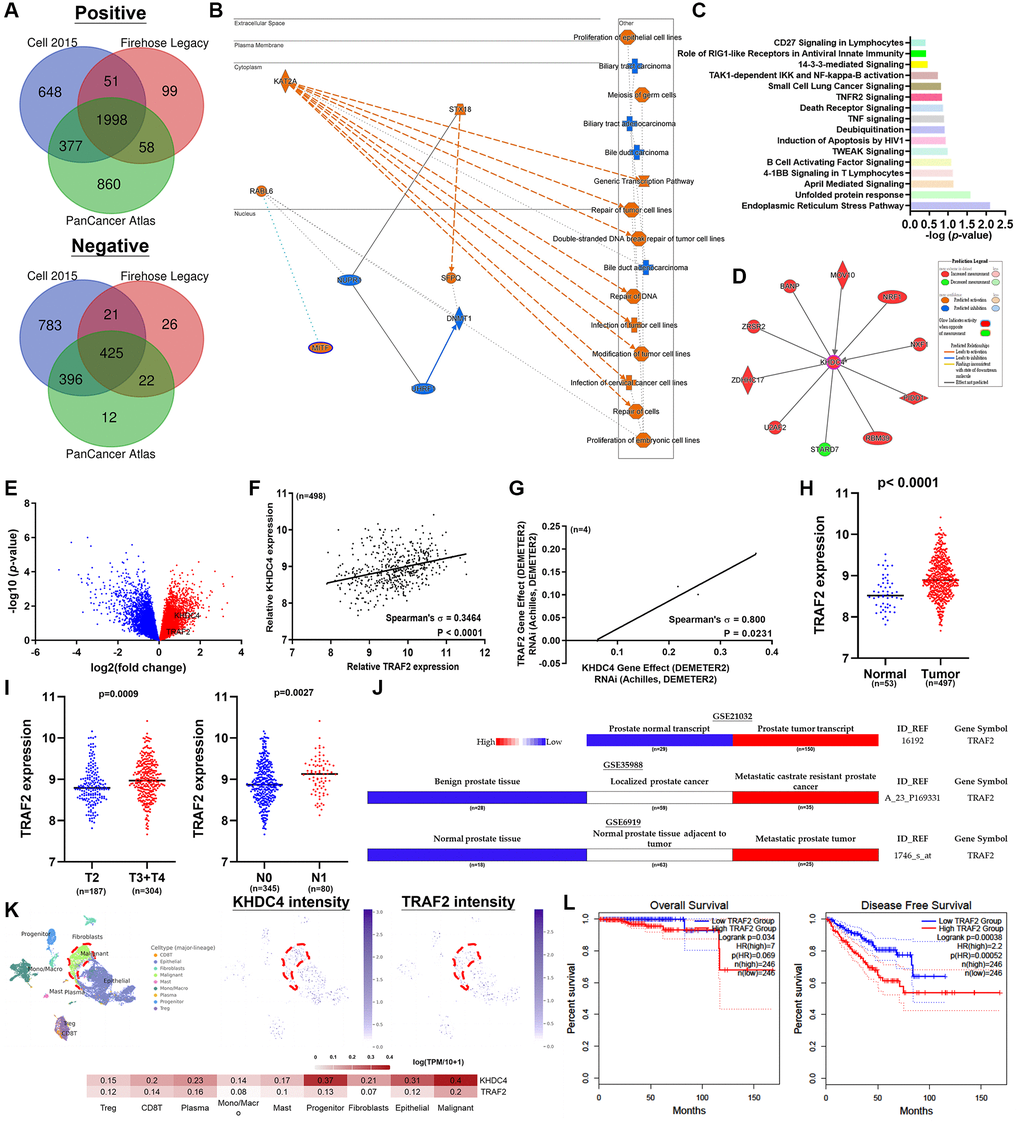 KHDC4-mediated adverse prognosis outcomes in prostate cancer are linked to the involvement of TRAF2. (A) A Venn diagram analysis was conducted to gather molecules that are positively or negatively correlated with KHDC4 in TCGA-PRAD datasets, including Cell 2015, Firehose Legacy, and PanCancer Atlas. (B) The graphical abstract illustrates the potential biological roles influenced by KHDC4 in prostate cancer. (C) The canonical pathways influenced by KHDC4-related molecules. (D) Molecular connections associated with KHDC4 regulation in prostate cancer. (E) Volcano plot depicts elevated TRAF2 levels in late-stage TCGA-PRAD patients. (F) The correlation between KHDC4 and TRAF2 in TCGA-PRAD patients. (G) The correlation between KHDC4 and TRAF2 in CCLE prostate cancer cell lines. (H) The related expression intensity of TRAF2 in TCGA-PRAD patients. (I) The difference in the level of TRAF2 between late-stage or lymph node metastasis in TCGA-PRAD patients. (J) The correlation of TRAF2 levels with advanced prostate cancer in different sources of prostate cohorts (GSE21032, GSE35988, GSE6919). (K) Analysis of single-cell sequencing profile (GSE176031) to examine the relative expression levels of KHDC4 and TRAF2 across different cell types. (L) The impact of TRAF2 expression levels on overall survival and disease-free survival rates in prostate cancer.
