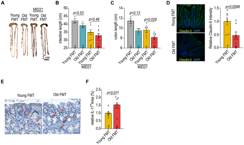 Impact of age-associated microbiome on gut homeostasis. (A) The gut morphology of aged female mice with FMT from young and old donors. (B) The intestinal length of female mice with reciprocal FMT. (C) The colon length of female mice with reciprocal FMT. (D) Immunofluorescent staining for claudin-5 in the intestines of female mice with reciprocal FMT (left panel). Relative claudin-5 expression in intestines of female mice with reciprocal FMT (right panel). (E) Immunohistochemical staining of IL-17A in the intestines of female mice with reciprocal FMT. (F) Quantification of IL-17A+ cells in the intestines of female mice with reciprocal FMT. Data in (B, C) were analyzed with Kruskal–Wallis followed by Dunn’s correction; data in (D, F) were analyzed with the two-sided Student’s t-test. Data are represented as mean ± SEM.