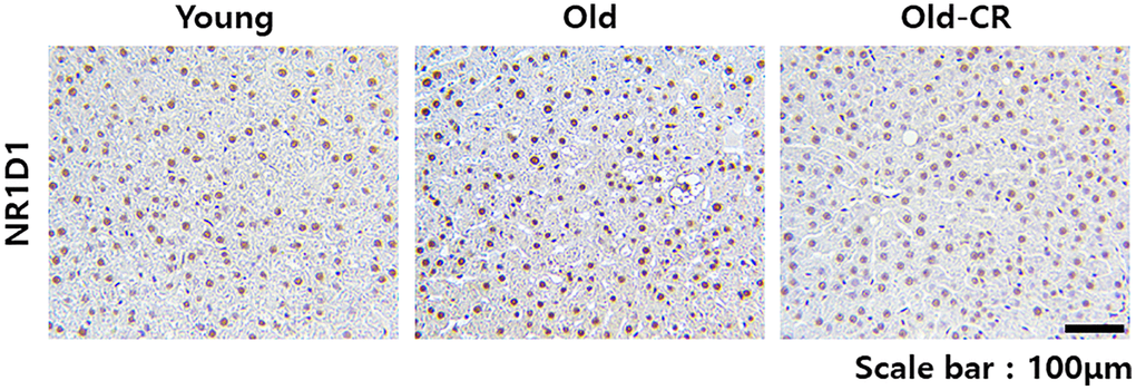 Immunohistochemical analysis of Nr1d1 expression in rat liver tissues during aging and CR. Nr1d1 protein expression is elevated in liver sections from aged mice compared to young controls, while CR intervention significantly attenuated this age-associated increase. Representative images of Nr1d1 staining of liver sections from the Young (left), Old (center), and Old-CR groups (right). Scale bar = 100 μm.